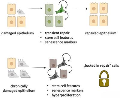 Senescent Cells in IPF: Locked in Repair?